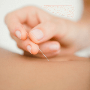 Akupunktur odense - overgangsalder