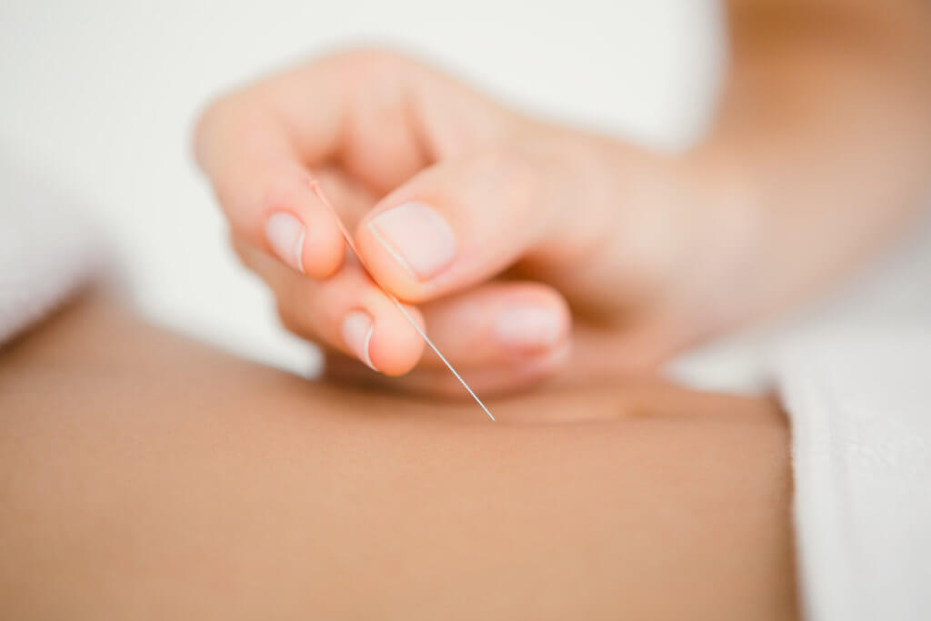 Få en bedre overgangsalder med akupunktur